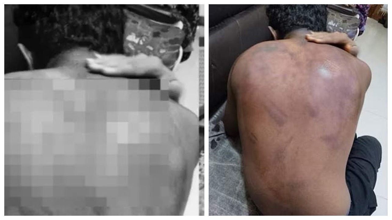இந்த வயசுல என்னடா ராகிங்..! “10-ம் வகுப்பு படிக்கும் போது இம்புட்டு வன்மமா”..? மிருகத்தனமாக போட்டு அடித்த 15 வயது சிறுவர்கள்…. மூடி மறைத்த பள்ளி நிர்வாகம்… கதறி துடிக்கும் பெற்றோர்…!