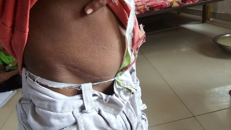 பிச்சை எடுத்த சிறுவர்கள்..! வயிற்றிலிருந்த அப்படி ஒரு காயம்… பணத்தை கூட அவங்கதான் எடுப்பார்களாம்… கிட்னியை கூட விட்டு வைக்கலையா…? வெடித்தது புதிய பூகம்பம்… அதிர்ச்சிகள் அதிகாரிகள்..!