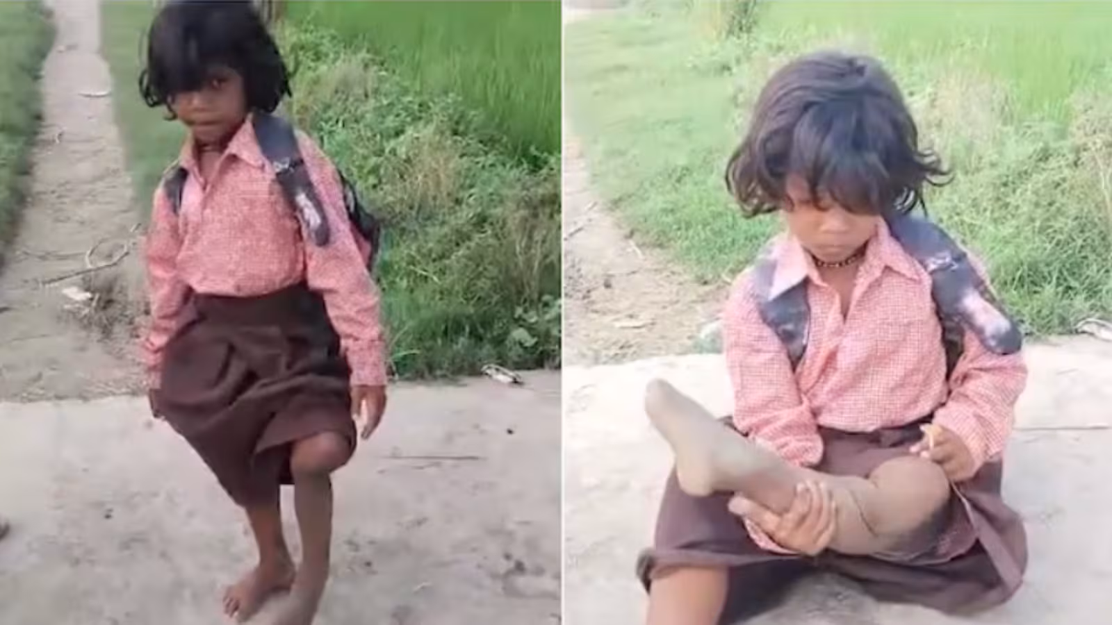 “எனக்கும் படிக்கனும் !”.. 400 மீட்டர் தூரம் ஒற்றைக் காலில் குதித்துச் செல்லும் 7வயது சிறுமி.. நெஞ்சை நெகிழ்விக்கும் சோகக் கதை..!!!