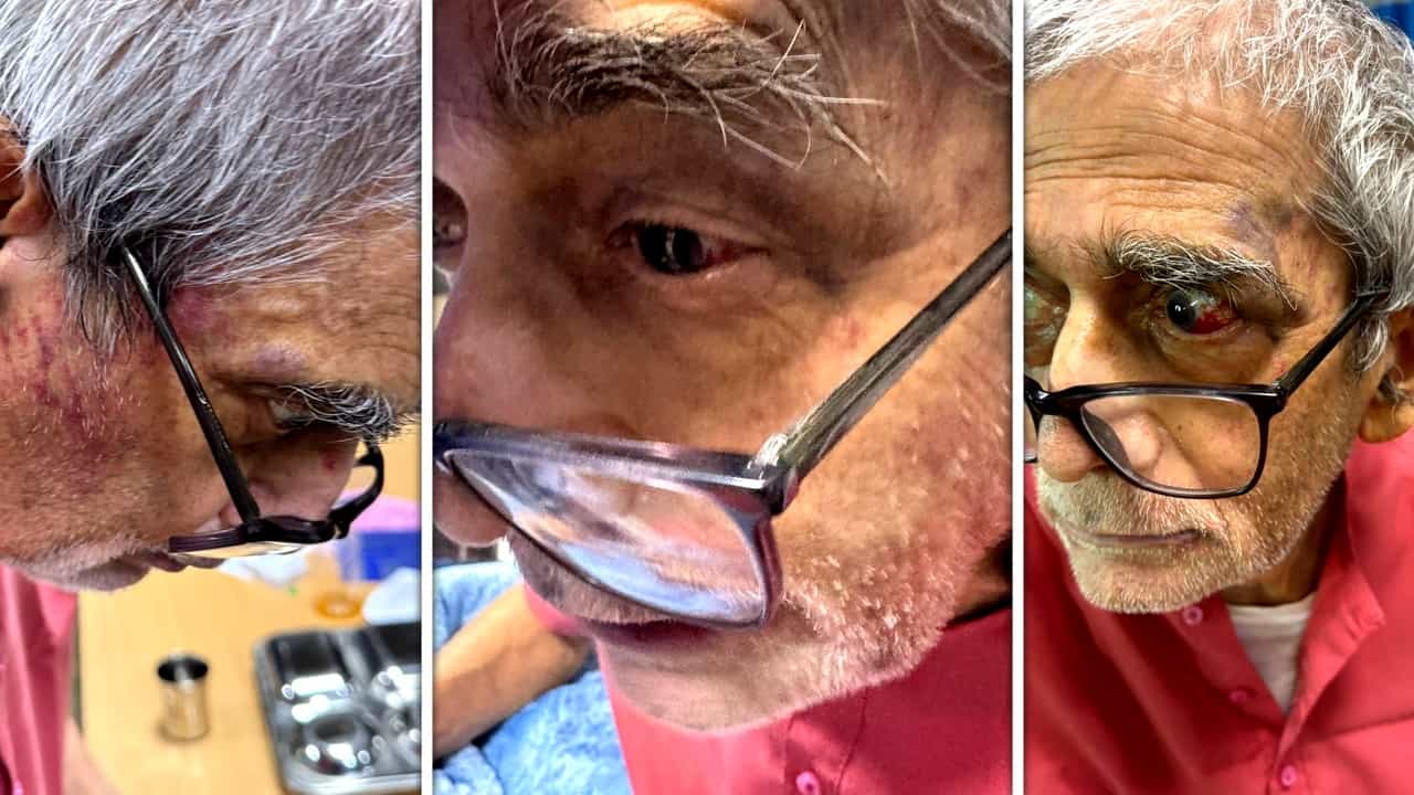 “பத்மஸ்ரீ விருது வாங்குன டாக்டருக்கே  மீது தாக்குதலா‌‌….?”  ஒரு வாரம் ஆகியும் நடவடிக்கை இல்லை…. பல்கலைக்கழக நிர்வாகம் மூடி மறைக்கப் பார்க்கிறதா….? அதிர்ச்சி பின்னணி….!!